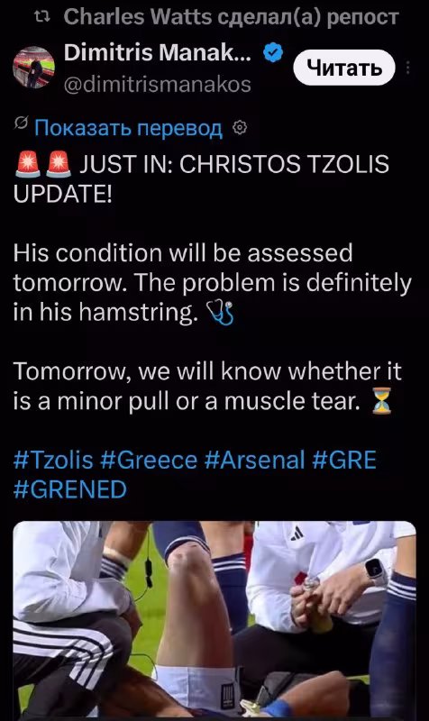 Xristos Tsolisning jarohati ertaga aniq bo'ladi